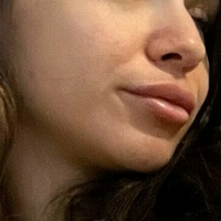 asxxo Desnuda