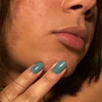 Melolo Desnuda