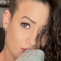 rocking_alopecia Desnuda